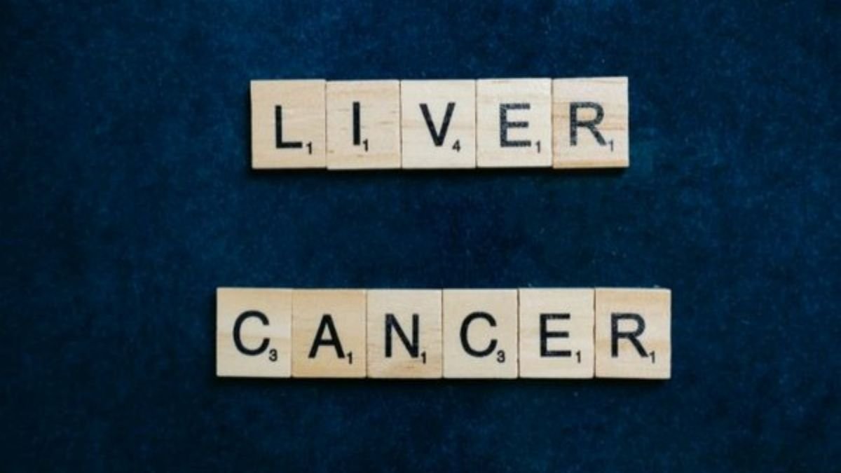 Research suggests radio-wave therapy is safe for liver cancer patients